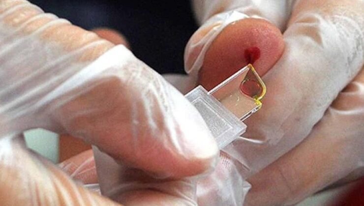 Tayland’da Keşfedilen Nadir Kan Grubu: Hibrit Enzimler ve Klinik Önemi