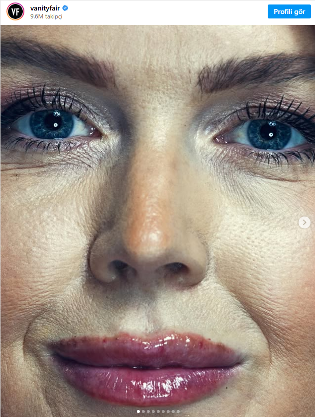 Vanity Fair Dosyası ve Beyaz Saray: Yönetim Basamaklarındaki Görsel Tartışma