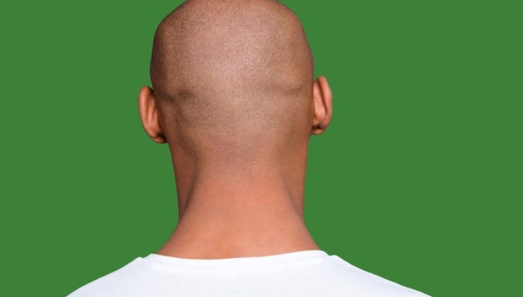 Rahibelerde Bilişsel Sağlık: Kafa Çevresi, Eğitim ve Erken Yaş Faktörlerinin Bilişsel Bozukluk Üzerindeki Etkileşimi