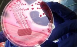 Dünya Kanser Günü: Önlenebilir Nedenler ve Küresel Etkileri Derinlemesine Değerlendirme