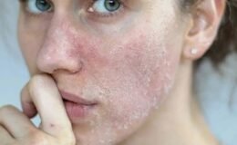 Kış Aylarında Cilt Bariyerini Güçlendirme Rehberi: Temizlikten Nemlendirmeye Uzman Tavsiyeleri