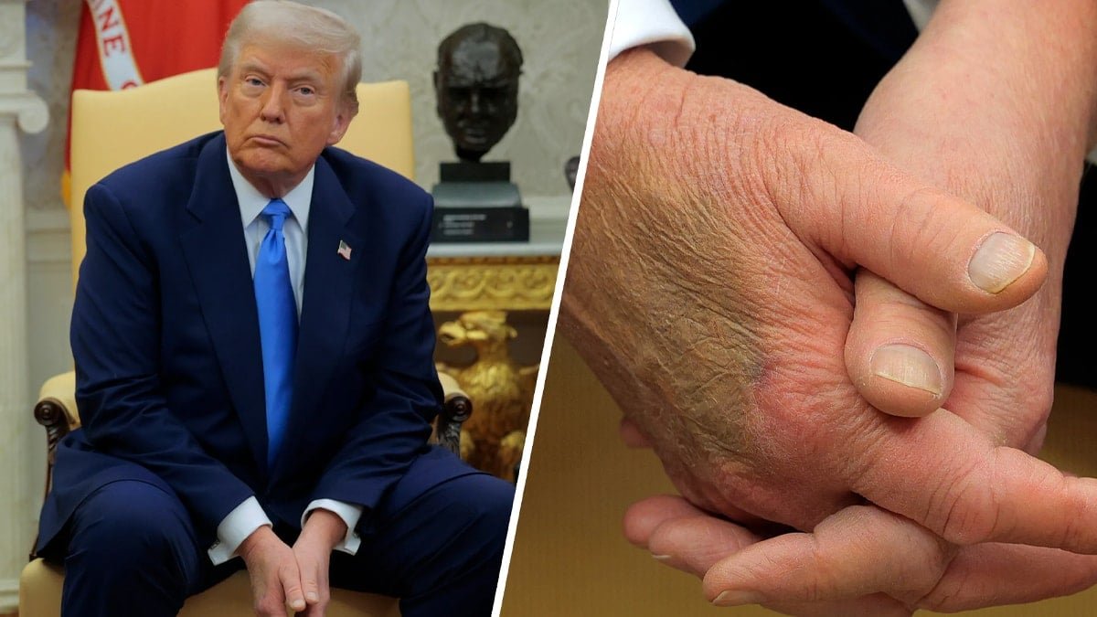 Beyaz Saray Sessizliği ve Sağlık Skandalı Söylentileri: Trump’ın Durumu Üzerindeki Belirsizlik