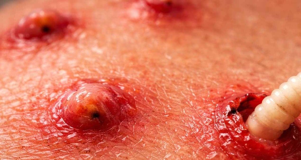 Perth’te 2015 Vakası: Uganda’da Yırtıcı Parazitlerin Kumaştan Yolculuğu ve Seyahat Güvenliği