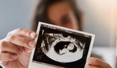Heteropaternal Süperfekondasyon: Genetik Gizeminin İlk Elden Anlatımı