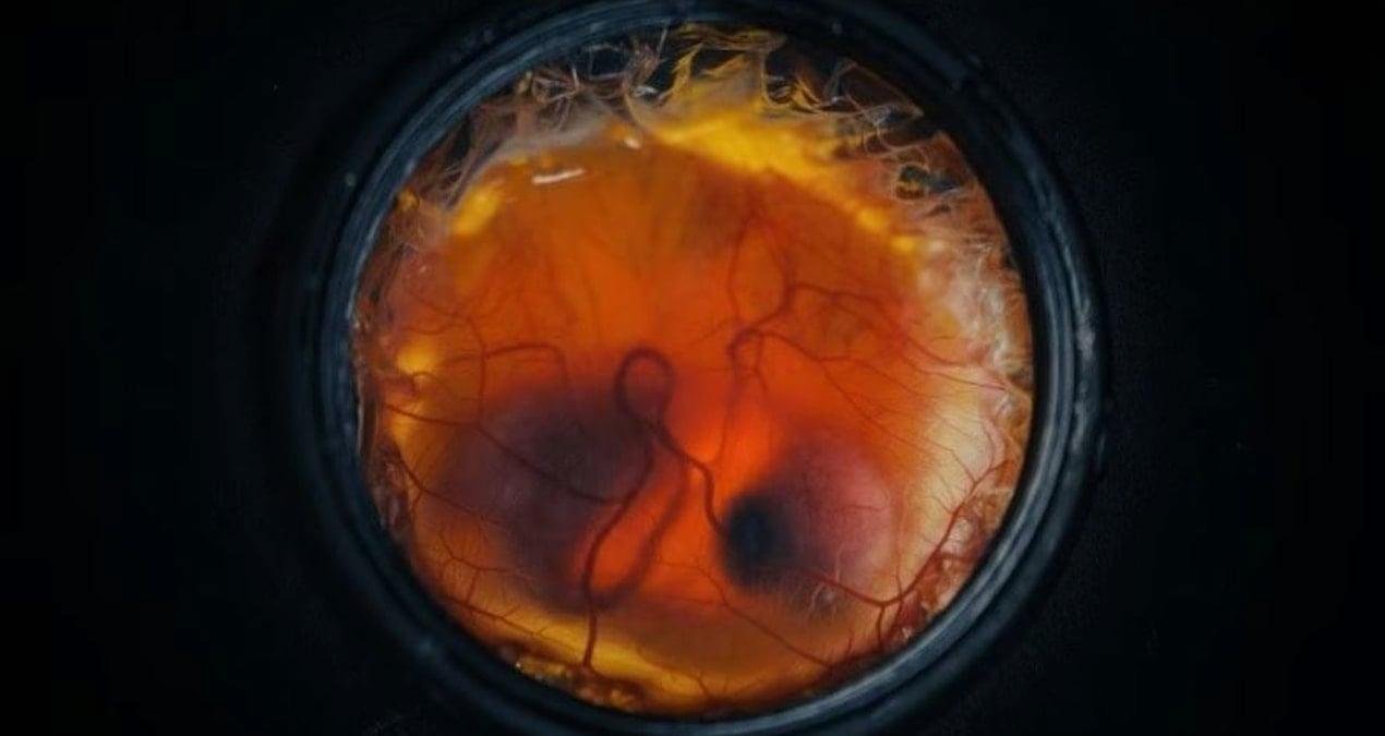 Kuș Embriyolojisinde Devrim Niteliğinde Yapay Dış Destek Sistemi ile De-extinction İçin Yeni Ufuklar