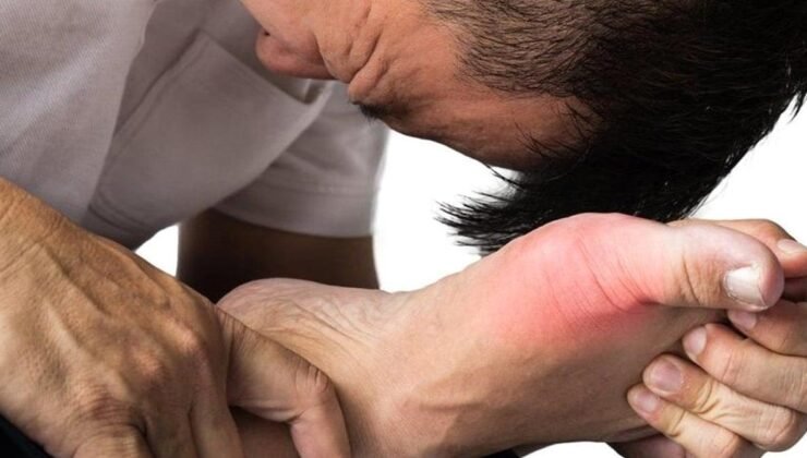 Ürik Asit Hakkında Detaylı Bilgilendirme ve Riskler